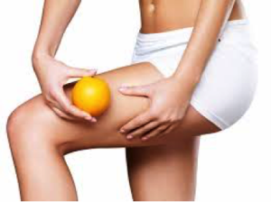 cellulite